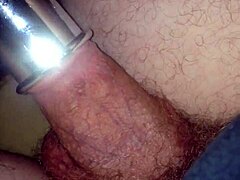 My wild ride with a vacuum suck