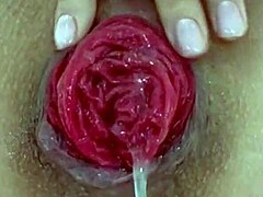 Destroyed Anal Prolapse in Extreme Close-Up Play