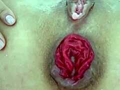 Destroyed Anal Prolapse in Extreme Close-Up Play