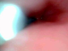 Wanna see male ejaculation caught on endoscope camera?