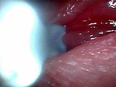 Endoscope Camera Records Male Ejaculation Moment in Raw Close-Up Detail. Shocking Visuals Inside!