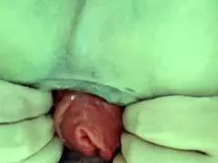 Mi Prolapso Anal Stretching with Pussy and Ass Insertion