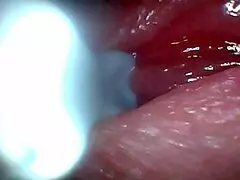 Wanna see male ejaculation caught on endoscope camera?