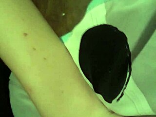 White Girl Head She Had A Bad Over Bite