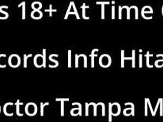 Doctor hits patient Lainey with hitachi orgasms in Tampa